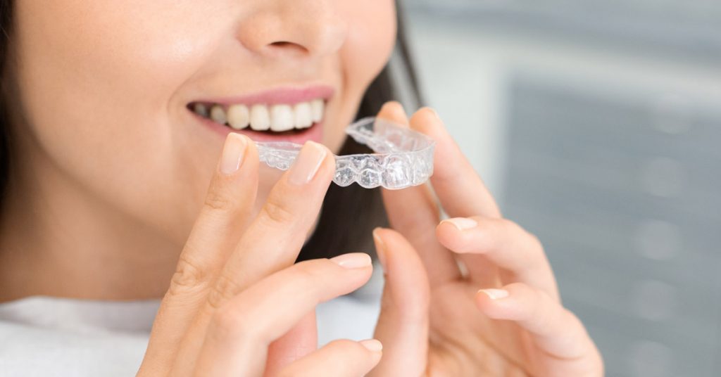 Mujer de cabello negro sosteniendo un alineador de Invisalign de los dientes superiores.